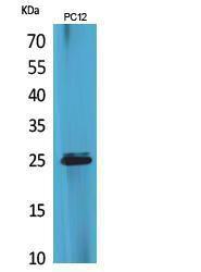 Western blot analysis of extracts from PC12 cells using Anti-CMTM5 Antibody