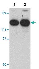 Anti-ZMYM2 Rabbit Polyclonal Antibody