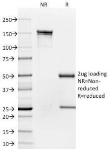 SDS-PAGE analysis of Anti-CD35 Antibody [To5] under non-reduced and reduced conditions; showing intact IgG and intact heavy and light chains, respectively. SDS-PAGE analysis confirms the integrity and purity of the antibody