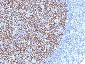 Immunohistochemical analysis of formalin-fixed, paraffin-embedded human tonsil using Anti-Bcl-6 Antibody [BCL6/1527]