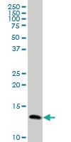 Anti-PFN1 Mouse Polyclonal Antibody