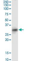 Anti-SIRT4 Mouse Monoclonal Antibody [clone: 1C8]