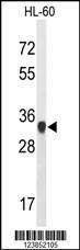 Anti-ATP5C1 Rabbit Polyclonal Antibody (FITC (Fluorescein Isothiocyanate))