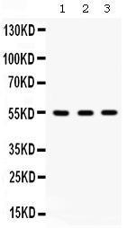 Anti-Integrin linked ILK Antibody