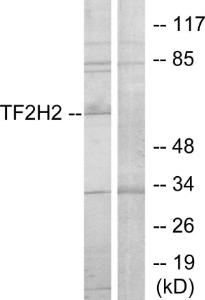 Western blot analysis of lysates from COLO205 cells using Anti-TF2H2 Antibody. The right hand lane represents a negative control, where the antibody is blocked by the immunising peptide