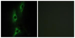 Immunofluorescence analysis of NIH/3T3 cells using Anti-ADRB2 Antibody. The right hand panel represents a negative control, where the antibody was pre-incubated with the immunising peptide