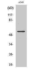 Western blot analysis of A549 cells using Anti-Vimentin Antibody