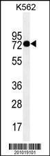 Anti-TGM2 Mouse Monoclonal Antibody [clone: 207CT39.5.5]