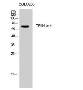 Western blot analysis of COLO205 cells using Anti-TF2H2 Antibody