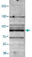 Anti-MBD4 Rabbit Polyclonal Antibody