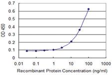 Anti-SIRT4 Mouse Monoclonal Antibody [clone: 1C8]