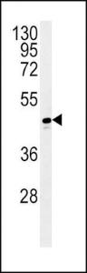 Anti-ADH1C Rabbit Polyclonal Antibody (FITC (Fluorescein Isothiocyanate))