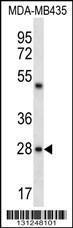 Anti-CDRT15L2 Rabbit Polyclonal Antibody (APC (Allophycocyanin))