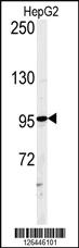 Anti-ATXN2L Rabbit Polyclonal Antibody