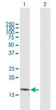 Anti-PFN1 Mouse Polyclonal Antibody