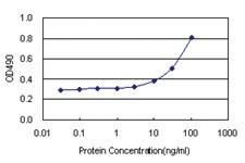 Anti-QPRT Polyclonal Antibody Pair