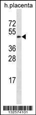 Anti-GAL3ST4 Rabbit Polyclonal Antibody (FITC (Fluorescein Isothiocyanate))