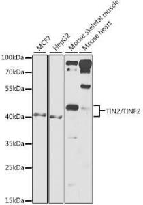 Western blot analysis of extracts of various cell lines, using Anti-Tin2 Antibody (A12016) at 1:1000 dilution. The secondary Antibody was Goat Anti-Rabbit IgG H&L Antibody (HRP) at 1:10000 dilution. Lysates/proteins were present at 25 µg per lane