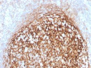 Immunohistochemical analysis of formalin-fixed, paraffin-embedded human tonsil using Anti-CD35 Antibody [CR1/4382R]