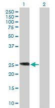 Anti-IL6 Rabbit Polyclonal Antibody