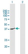 Anti-SIRT3 Mouse Polyclonal Antibody