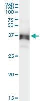 Anti-ACAD8 Polyclonal Antibody Pair