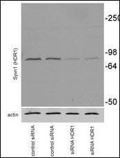 Anti-SYVN1 Rabbit Polyclonal Antibody (HRP (Horseradish Peroxidase))