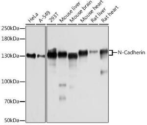 Western blot analysis of extracts of various cell lines, using Anti-N Cadherin Antibody (A305590) at 1:1000 dilution. The secondary Antibody was Goat Anti-Rabbit IgG H&L Antibody (HRP) at 1:10000 dilution