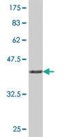 Anti-WIF1 Mouse Polyclonal Antibody