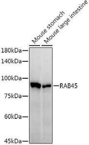 Anti-RAB45 Rabbit Monoclonal Antibody [clone: ARC3022]