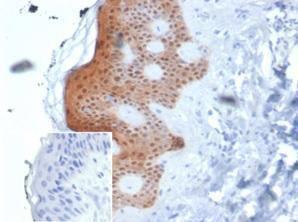 Immunohistochemical analysis of formalin-fixed, paraffin-embedded human skin tissue using Anti-Maspin Antibody [SERPINB5/4975]. Inset: PBS instead of the primary antibody. Secondary antibody negative control