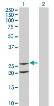 Anti-IL6 Mouse Monoclonal Antibody [clone: 3E4]