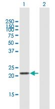 Anti-LVRN Mouse Polyclonal Antibody