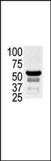 Anti-PAK2 Rabbit Polyclonal Antibody (Biotin)