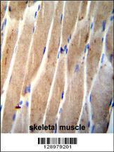 Anti-CLEC4F Rabbit Polyclonal Antibody (HRP (Horseradish Peroxidase))