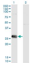 Anti-SIRT3 Mouse Monoclonal Antibody [clone: 1A4]