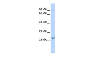 Anti-LRTOMT Rabbit Polyclonal Antibody