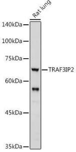 Western blot analysis of extracts of Rat lung, using Anti-CIKS / ACT1 Antibody (A12017) at 1:1000 dilution