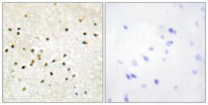 Immunohistochemical analysis of paraffin-embedded human brain tissue using Anti-TF2H1 Antibody. The right hand panel represents a negative control, where the antibody was pre-incubated with the immunising peptide