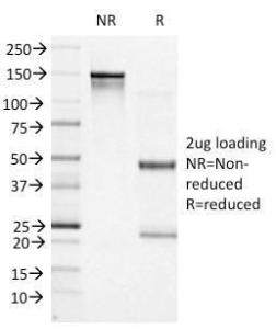 SDS-PAGE analysis of Anti-Bcl-6 Antibody [BCL6/1527] under non-reduced and reduced conditions; showing intact IgG and intact heavy and light chains, respectively. SDS-PAGE analysis confirms the integrity and purity of the antibody