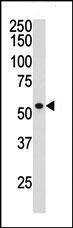 Anti-HDAC1 Rabbit polyclonal antibody