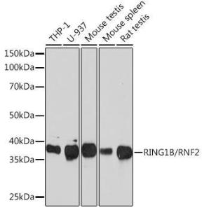 Western blot analysis of extracts of various cell lines, using Anti-RING2/RING1B/RNF2 Antibody [ARC0802] (A306709) at 1:1000 dilution. The secondary Antibody was Goat Anti-Rabbit IgG H&L Antibody (HRP) at 1:10000 dilution. Lysates/proteins were present at 25 µg per lane