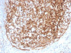 Immunohistochemical analysis of formalin-fixed, paraffin-embedded human tonsil using Anti-CD35 Antibody [CR1/4382R]