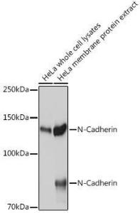 Western blot analysis of extracts of HeLa cells, using Anti-N Cadherin Antibody (A305590) at 1:1000 dilution. The secondary Antibody was Goat Anti-Rabbit IgG H&L Antibody (HRP) at 1:10000 dilution. L