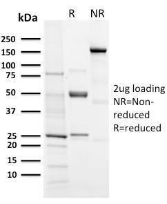 Anti-Aurora B Rabbit Recombinant Antibody [clone: AURKB/3121R]