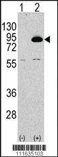 Anti-PRKCA Rabbit Polyclonal Antibody