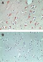 Anti-FAM3C Rabbit Polyclonal Antibody