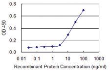 Anti-SIRT3 Mouse Monoclonal Antibody [clone: 1A4]