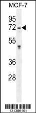 Anti-GALNS Rabbit Polyclonal Antibody (APC (Allophycocyanin))