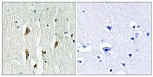 Immunohistochemical analysis of paraffin-embedded human brain tissue using Anti-PAK1 + PAK2 + PAK3 Antibody. The right hand panel represents a negative control, where the Antibody was pre-incubated with the immunising peptide